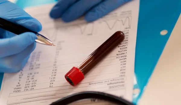 How to Understand Your Blood Test Report Before Seeing a Doctor